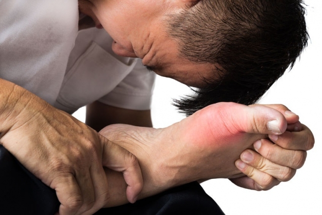 Dấu hiệu bệnh gout ở chân và cách điều trị
