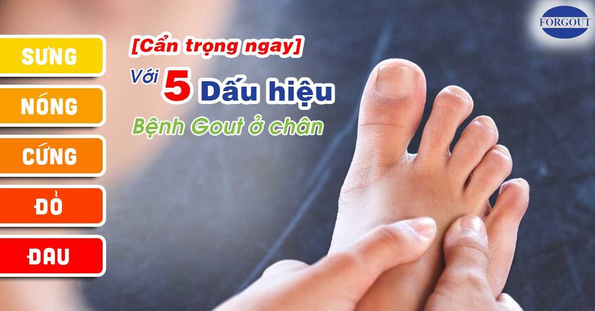 Cẩn trọng ngay 5 dấu hiệu bệnh gout ở chân