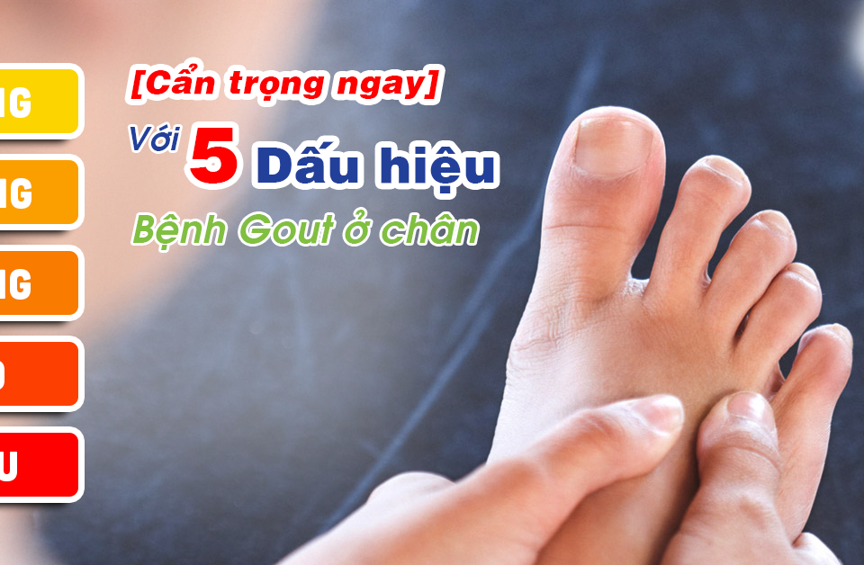 Cẩn trọng ngay 5 dấu hiệu bệnh gout ở chân