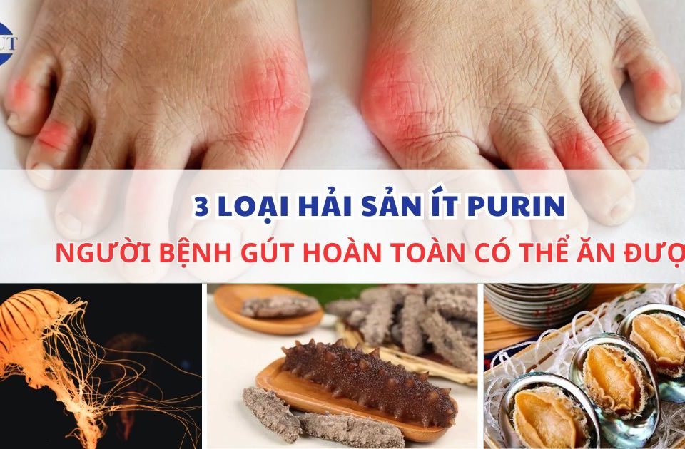 3 loại hải sản ít purin người bệnh gout hoàn toàn có thể ăn được