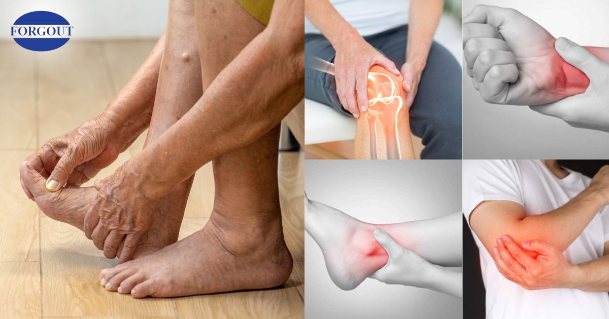 Triệu chứng dễ nhận biết nhất là cơn đau xảy ra ở khớp ngón chân cái